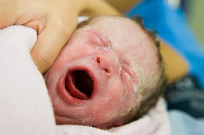 Baby - Just Born and crying Vernix Caseosa