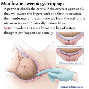 sweeping of the membranes